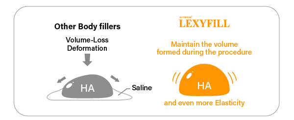 Other body fillers experience volume loss and deformation as saline gradually escapes from the HA structure. LEXYFILL body filler not only maintain the volume achieved during the procedure but also enhances elasticity