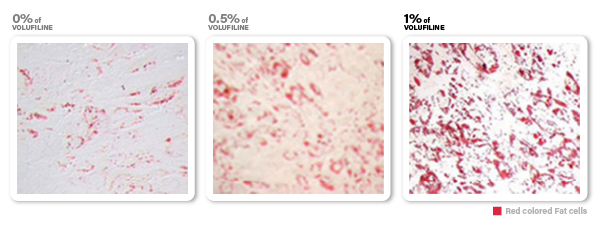 VOLUFILINE™ 0%, 0.5%, 1.0% Concentration clinical studies(fat cells photo)