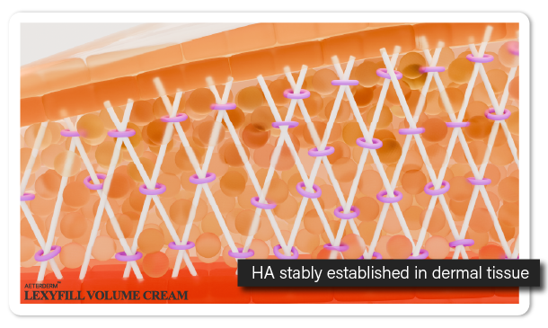 HA stably established in dermal tissue thanks to collagen and elastin production